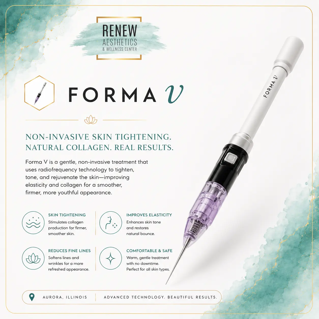 FormaV technology at Renew Aesthetics