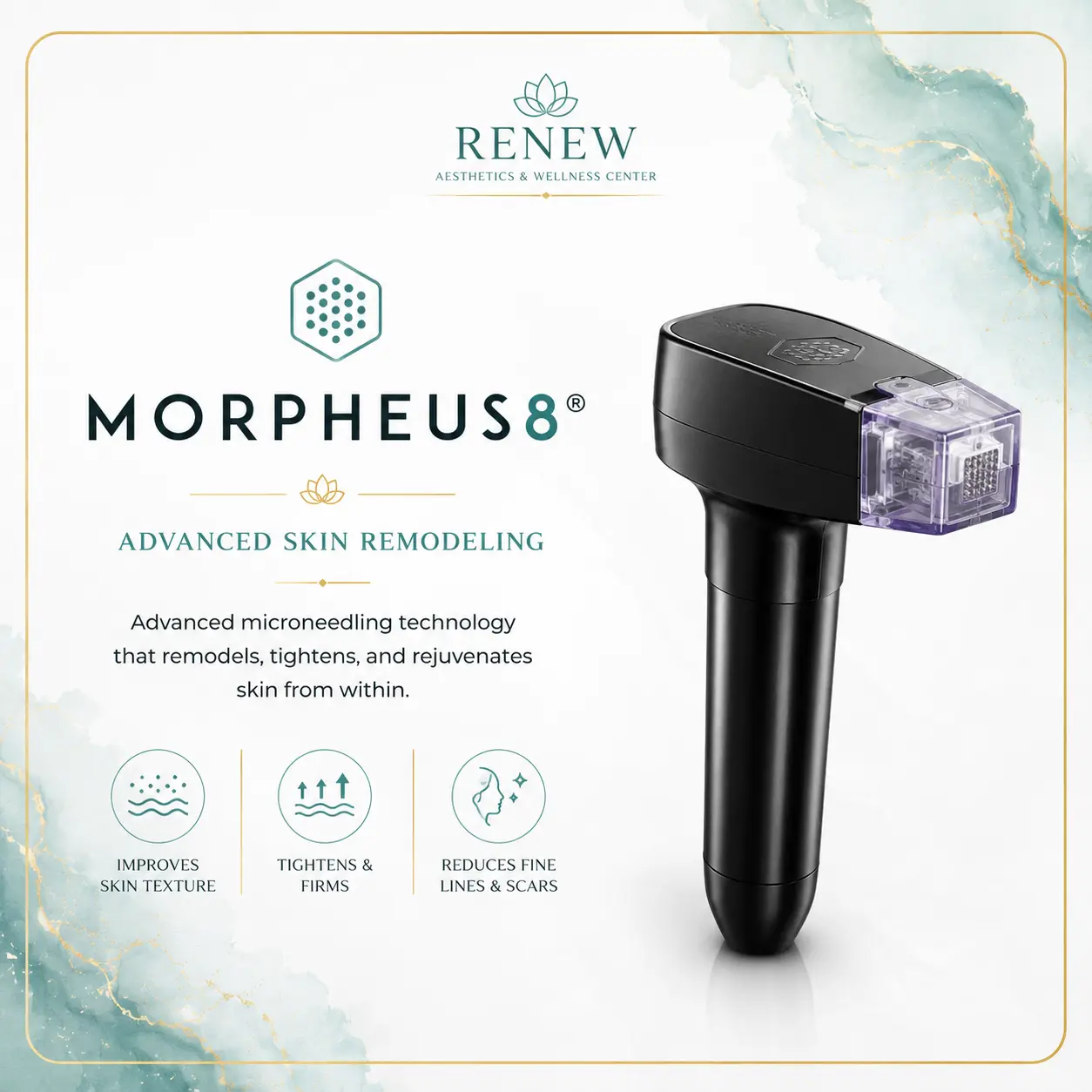 Morpheus8 skin remodeling technology at Renew Aesthetics